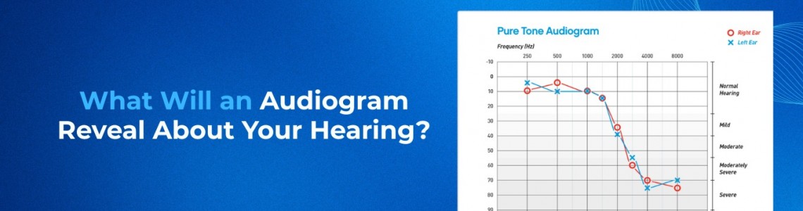 What Will an Audiogram Reveal About Your Hearing?