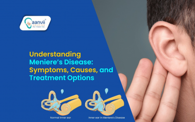 Understanding Meniere’s Disease: Symptoms, Causes, and Treatment Options