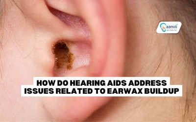 How Do Hearing Aids Address Issues Related to Earwax Buildup?