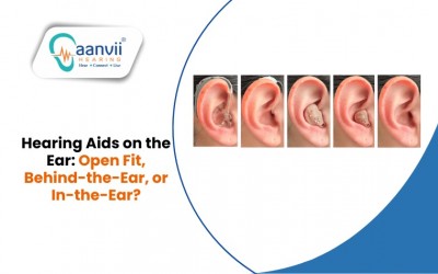 Hearing Aids on the Ear: Open Fit, Behind-the-Ear, or In-the-Ear?