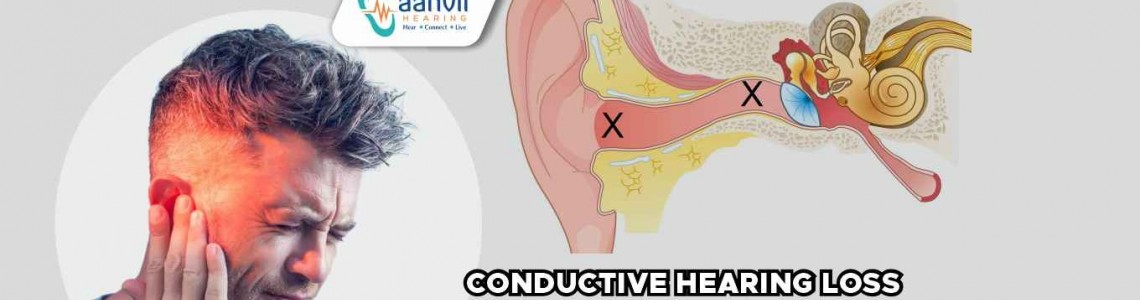 Understanding Conductive Hearing Loss: Causes and Characteristics