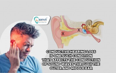 Understanding Conductive Hearing Loss: Causes and Characteristics
