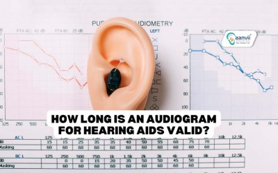 How Long Is An Audiogram or Prescription For Hearing Aids Valid?